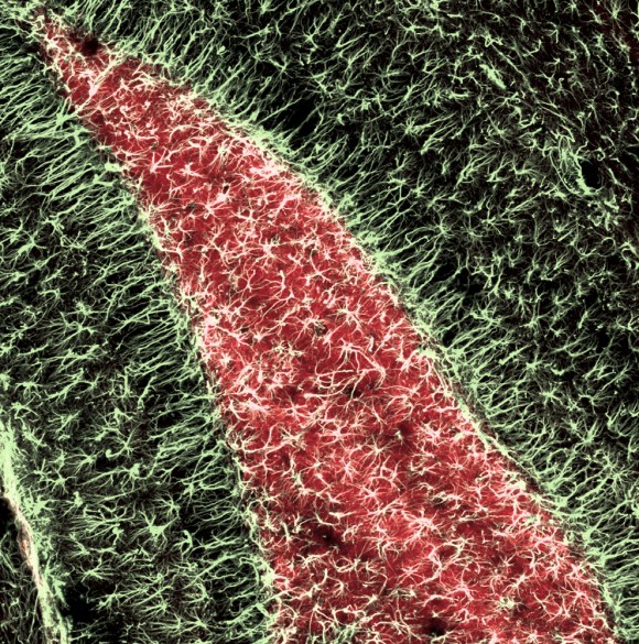 Specimen: Adult mouse hippocampus, a region of the brain involved in learning and memory. Reactive astroglia (pale yellow) have proliferated and enlarged in response to neuronal activity over time. Technique: Confocal microscopy, Z-stack of 7 slices. (Dr. Sandra Dieni/Institute of Anatomy and Cell Biology, Albert-Ludwigs University/Freiburg, Germany